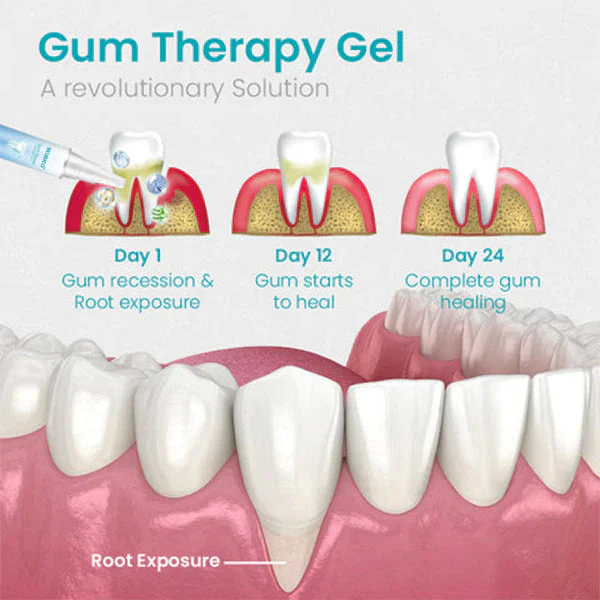 🔥Last Day 69% OFF-SEURICO™ Gum Shield Therapy Gel - Image 5